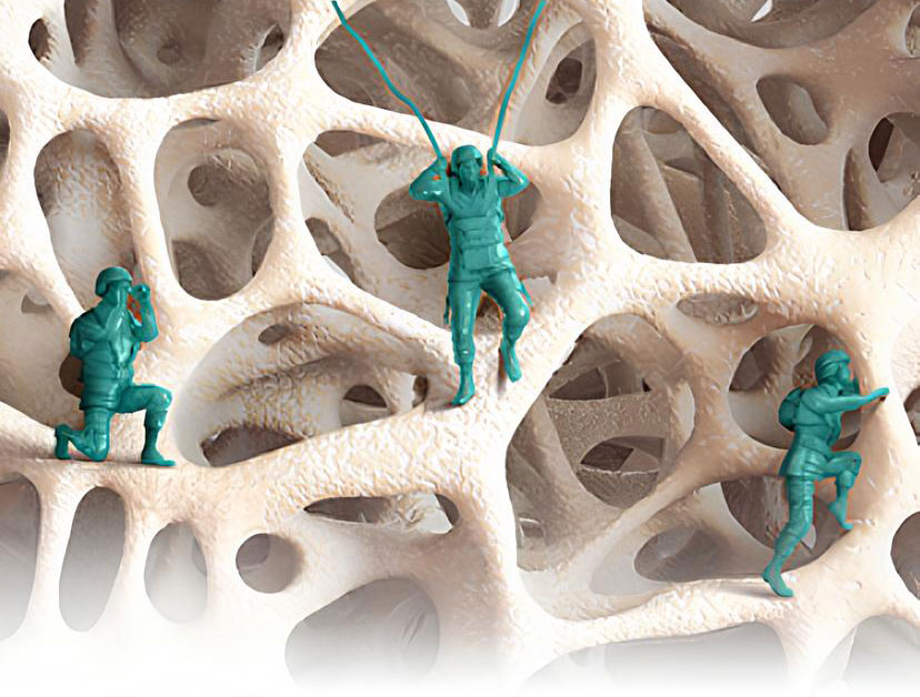 Composite image of green toy soldiers deployed inside a bone matrix